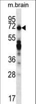Polyclonal Rabbit anti-Human REPS2 Antibody (aa153-182, IHC, WB)
