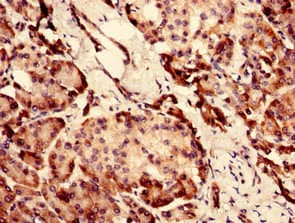 Polyclonal Rabbit anti-Human CHID1 Antibody (WB)