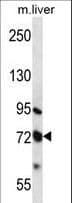 MMP17 Antibody (aa432-460)