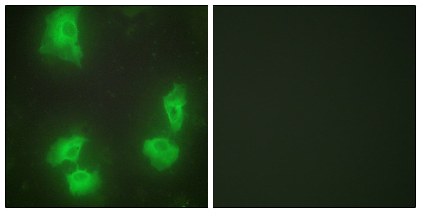 CDK5R1 Antibody (aa11-60)