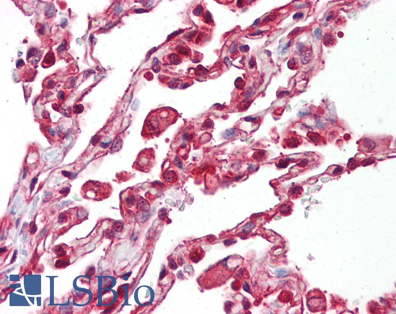 IHC-plus™ EIF4B Antibody (aa150-200)