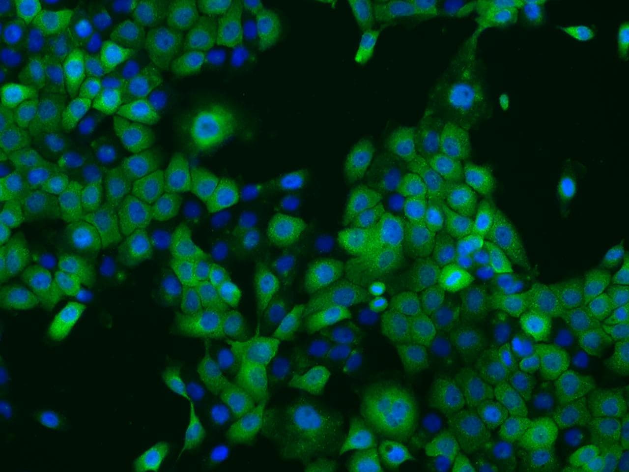 Polyclonal Rabbit anti-Human PPP2R1B Antibody (IHC, IF)