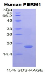 Human PBRM1 / BAF180 / PB1 Protein (Recombinant His)
