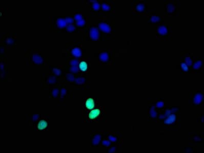Recombinant Monoclonal Rabbit anti-Human HIST1H1E Antibody (IHC, IF)