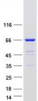 Human UPF3B Protein (Recombinant Myc-DDK (Flag))