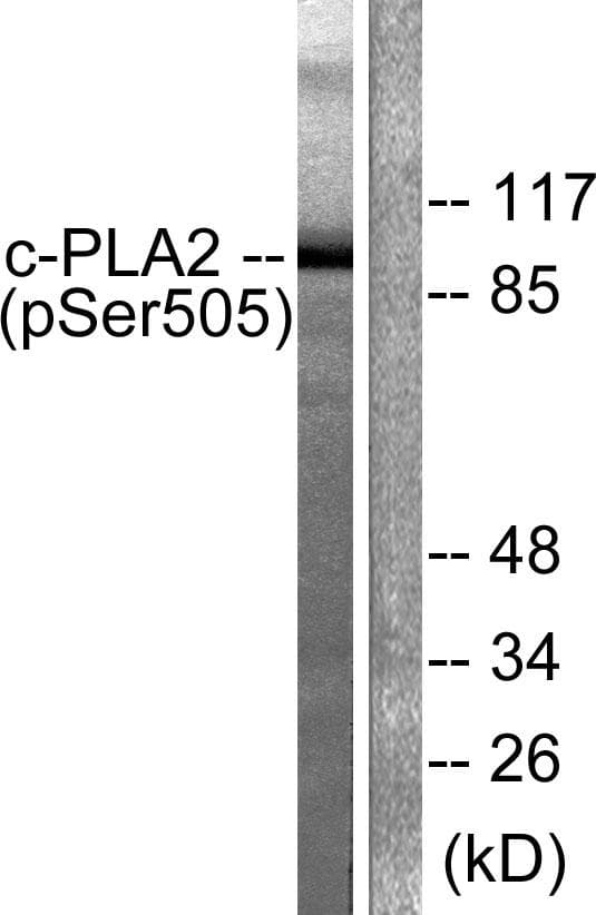 PLA2G4A Antibody (phospho-Ser505)