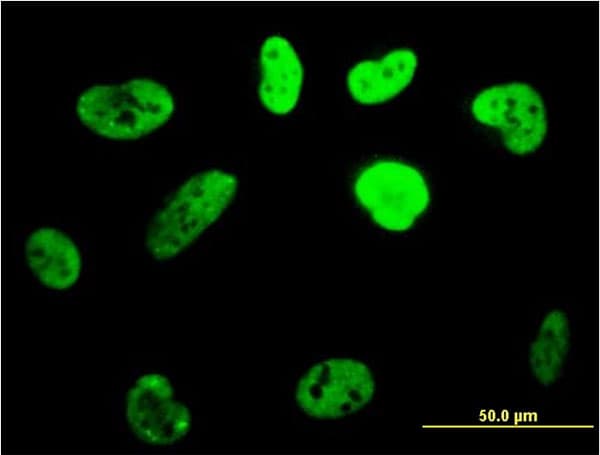 PathPlus™ CBFA1 / RUNX2 Antibody (clone 4D5)