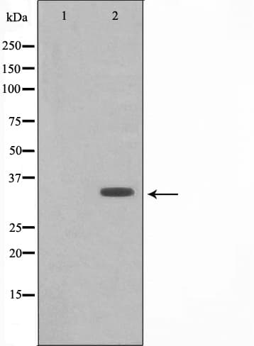 PPP1R1B / DARPP-32 Antibody