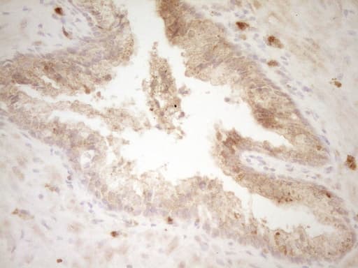 SLAMF7 / CRACC Antibody (clone OTI1F1)