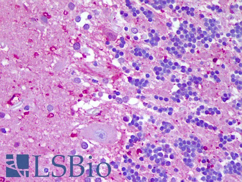 IHC-plus™ Polyclonal Rabbit anti-Human NLRP8 Antibody (IHC, WB)