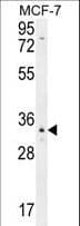 OR6C4 Antibody (aa242-270)