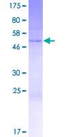 Human SBSN Protein (Recombinant GST)