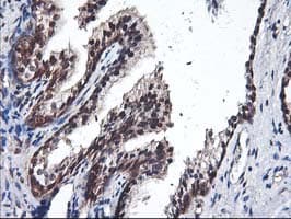 ALS2CR1 / NIF3L1 Antibody (clone OTI4B5)