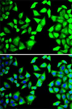 Polyclonal Rabbit anti-Human EIF3H / EIF3S3 Antibody (IHC, IF, WB)