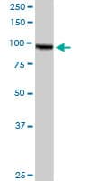 Monoclonal Mouse anti-Human AMPD2 Antibody (clone 6A8, WB)