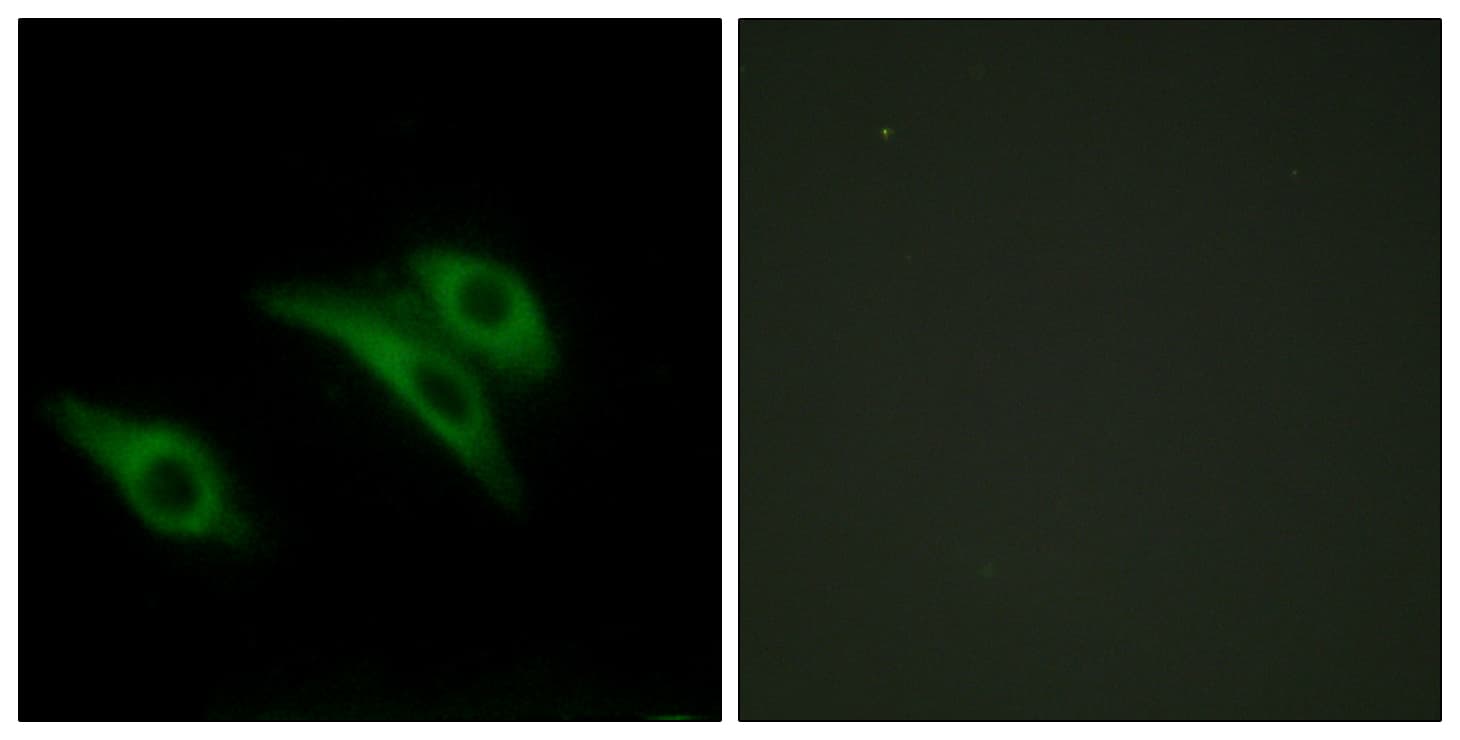 CD9 Antibody (aa101-150)