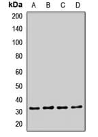 EXOSC2 / RRP4 Antibody