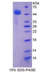 Human TNFRSF1A / TNFR1 Protein (Recombinant His-GST)