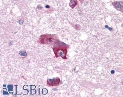 PathPlus™ HTR7 / 5HT7 Receptor Antibody (C-Terminus)