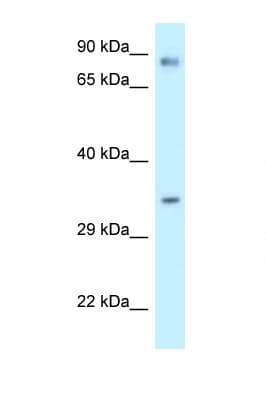 CALU / Calumenin Antibody (C-Terminus)