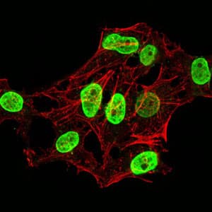 Monoclonal Mouse anti-Human HIST2H4A Antibody (clone 3E7D9, IHC)