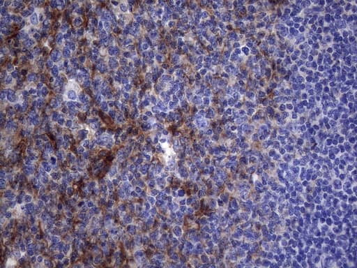 Monoclonal Mouse anti-Human CRP / C-Reactive Protein Antibody (clone OTI1H1, IHC, WB)