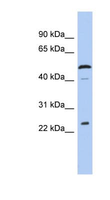 Polyclonal Rabbit anti-Human C1orf190 Antibody (aa143-192, WB)