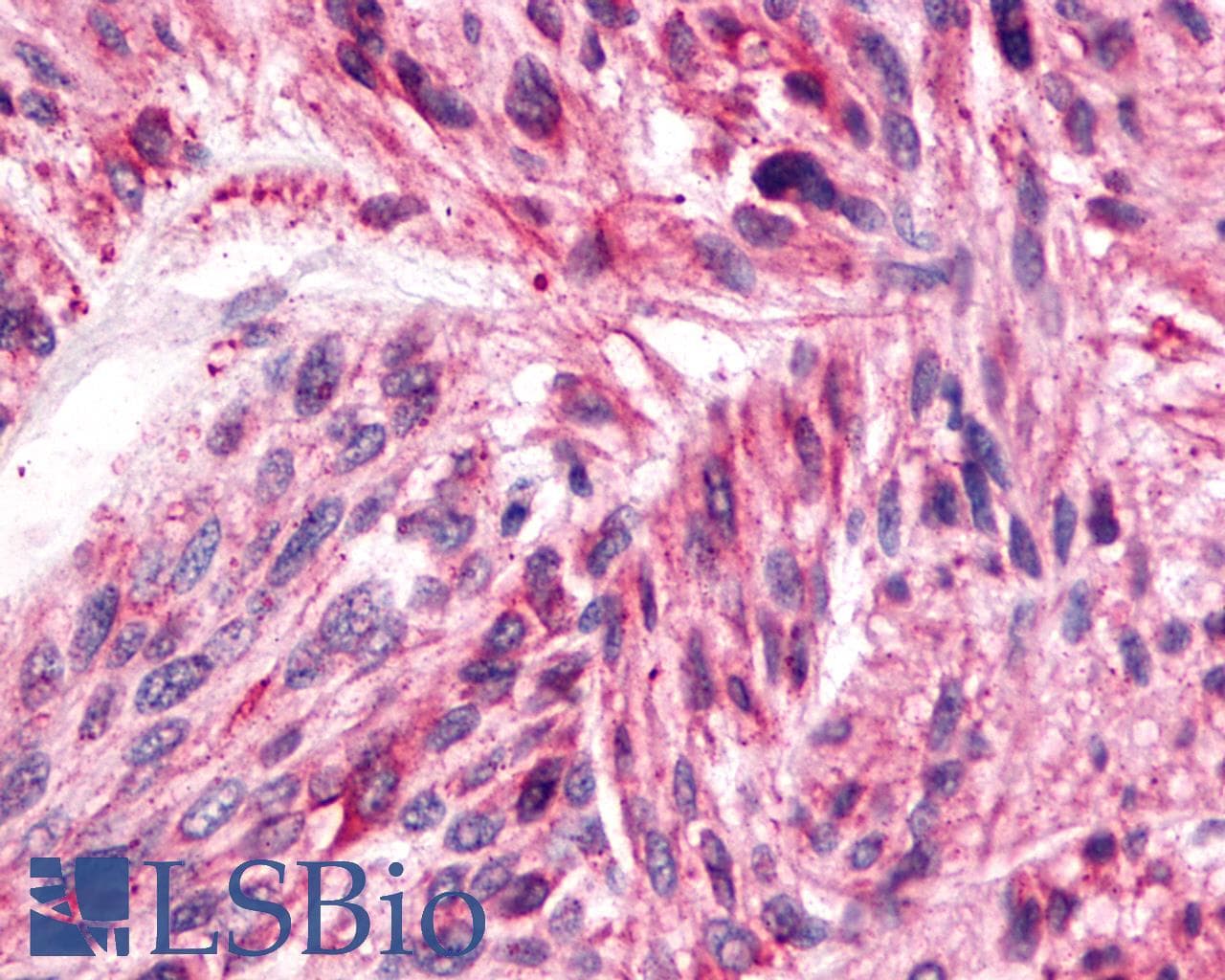 IHC-plus™ SSTR4 Antibody (N-Terminus)