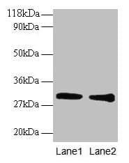 IHC-plus™ Polyclonal Rabbit anti-Human GSTP1 / GST Pi Antibody (aa 2-210, IHC, WB)