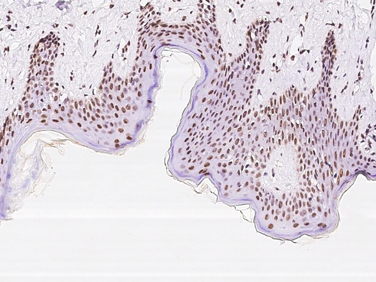 EWSR1 / EWS Antibody