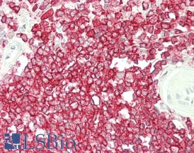 PathPlus™ CORO1A / Coronin 1a Antibody (aa250-300)