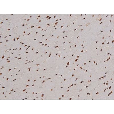 FAK / Focal Adhesion Kinase Antibody (phospho-Tyr397)