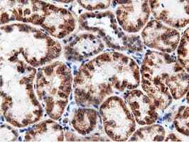AK5 / Adenylate Kinase 5 Antibody (clone OTI2F9)