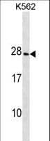 CRYGD / CCP Antibody (aa73-101)