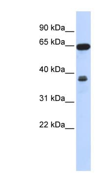 RCC2 Antibody (aa431-480)