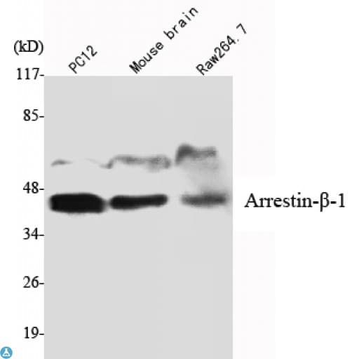 ARRB1 / Beta Arrestin 1 Antibody