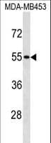 SKAP1 / SCAP1 Antibody (aa266-295)