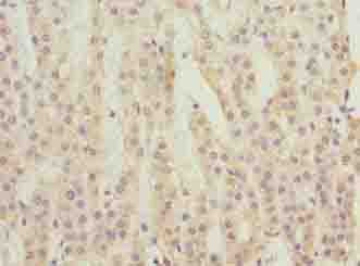 C3orf18 Antibody