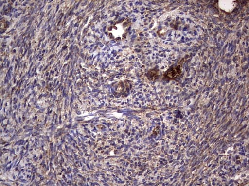DOCK8 Antibody (aa832-1160, clone OTI4H10)