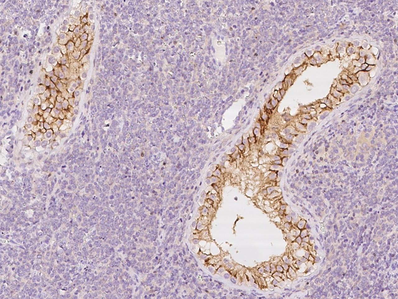 JAM3 Antibody