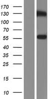 TSAP6 / STEAP3 Protein (Over-Expression Lysate Myc-DDK (Flag))