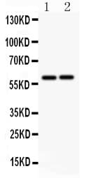 Polyclonal Rabbit anti-Human LTBR Antibody (aa420-435, IHC, WB)