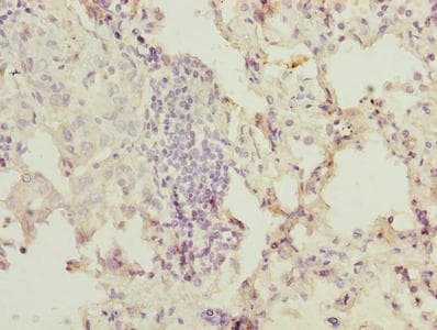 Polyclonal Rabbit anti-Human OGT / O-GLCNAC Antibody (aa606-1022, IHC)