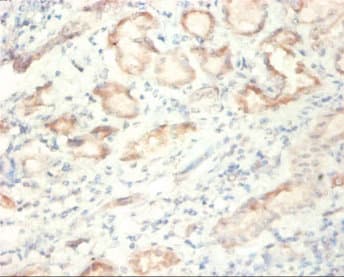 SDHA Antibody