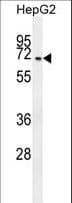 CFAP45 / CCDC19 Antibody (aa106-135)