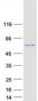 Human UGP2 Protein (Recombinant Myc-DDK (Flag))