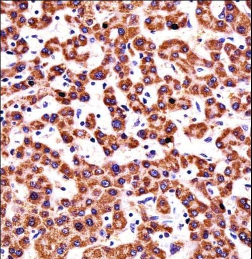 CYP2D6 Antibody (aa76-105)