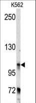 BICD2 Antibody (aa787-818)