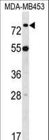 LDB3 / ZASP Antibody (aa235-262)