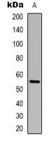 CYP21A2 Antibody (Internal)